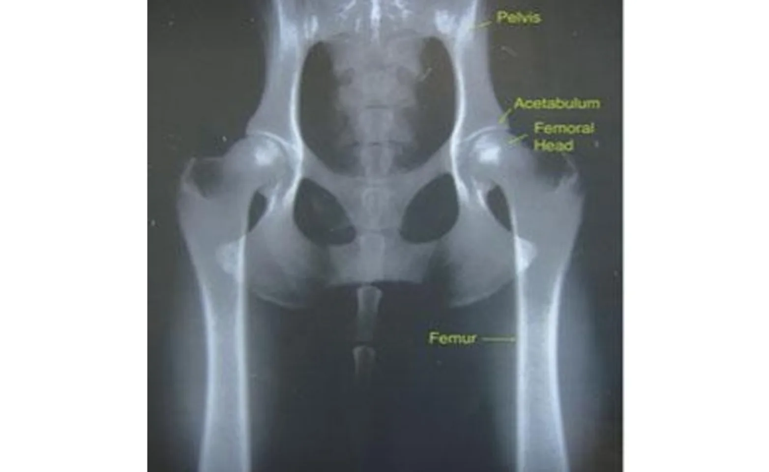 Normal canine hips with important anatomical features highlighted. Normal canine hips with important anatomical features highlighted.