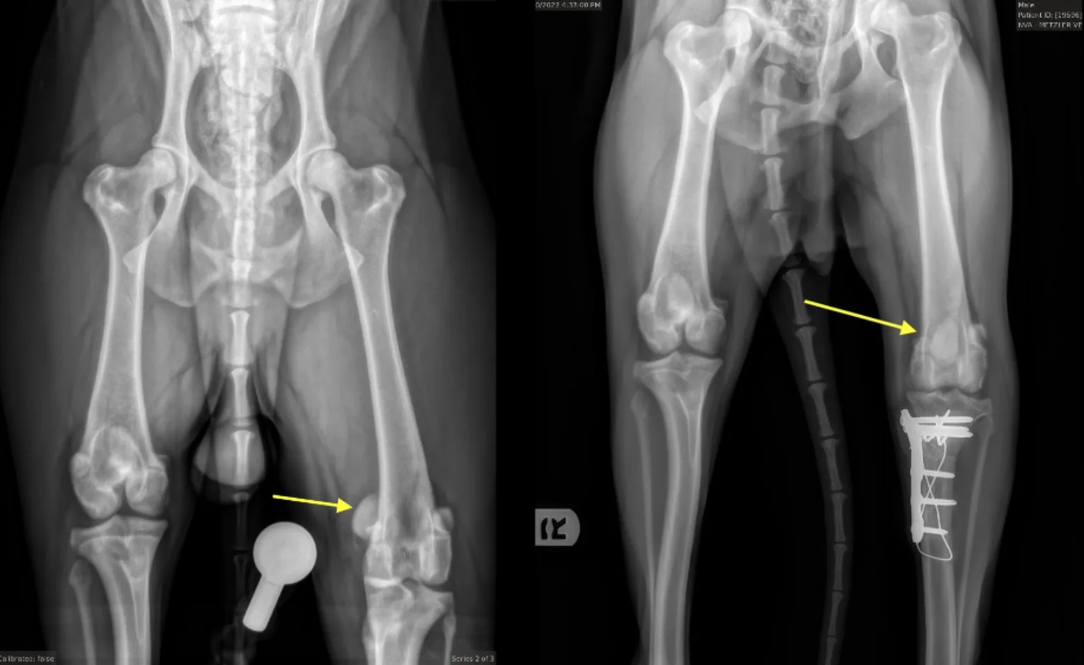 Orthopedic Surgery X-Ray