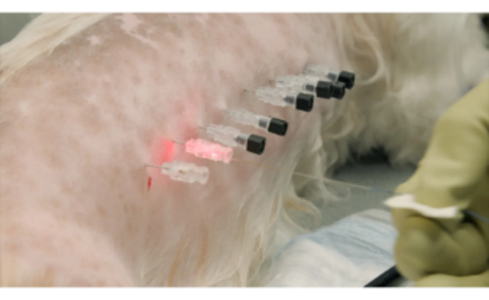 Laser Disc Ablation: Preventing Intervertebral Disc Disease (IVDD