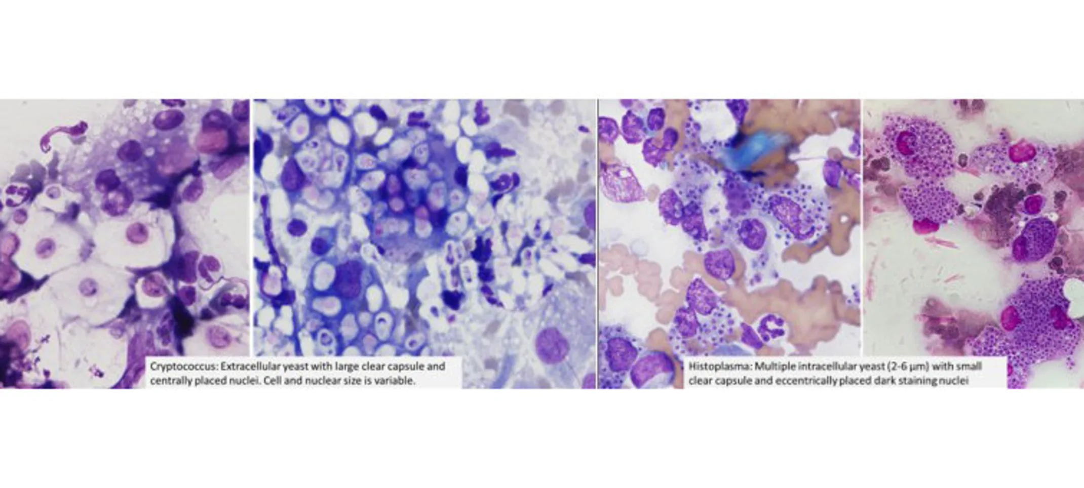Histoplasmosis in Dogs and Cats | Overland Park Veterinary Emergency ...