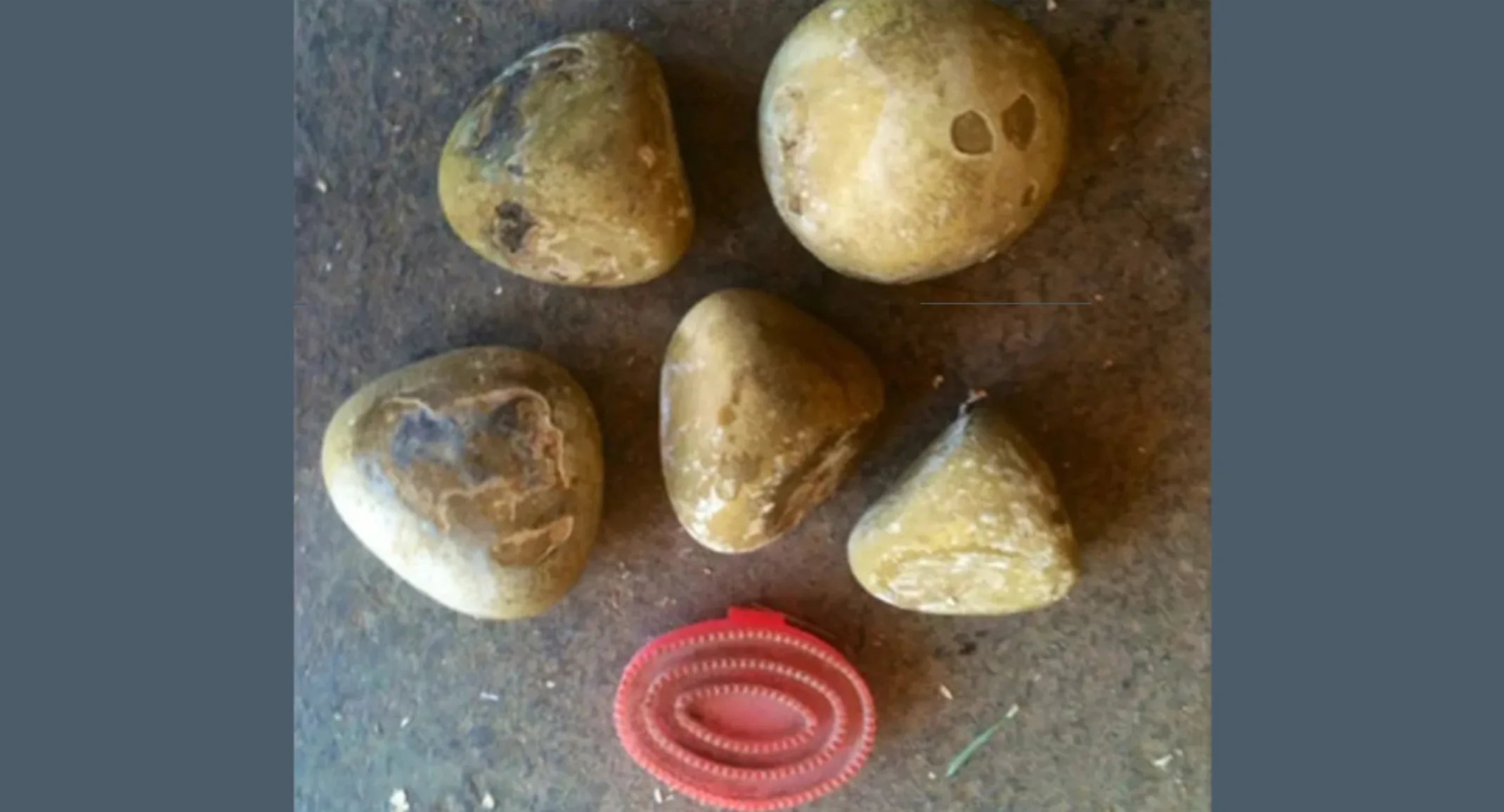 5 Enteroliths (mineral struvite) found inside a horse 5 Enteroliths (mineral struvite) found inside a horse