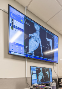 Images of radiography