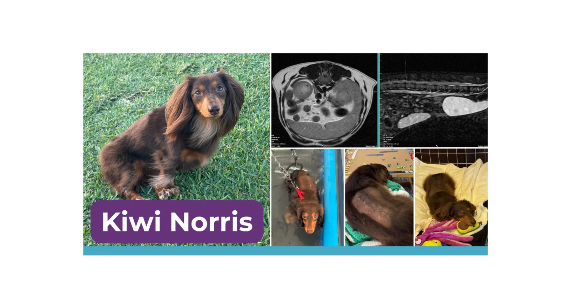 Kiwi’s Comeback: A Dachshund’s Journey from Paralysis to Recovery Kiwi’s Comeback: A Dachshund’s Journey from Paralysis to Recovery