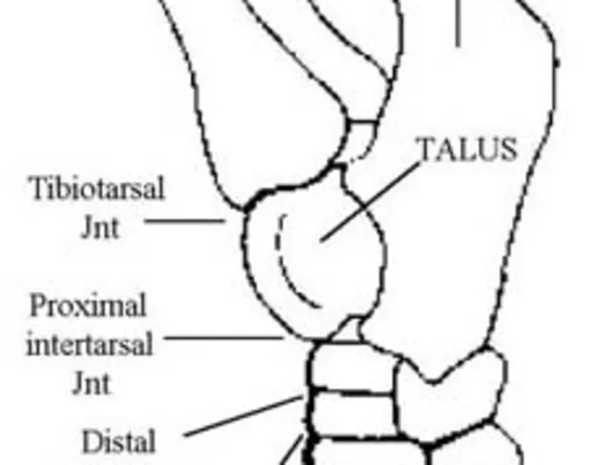South Shore Equine Clinic & Diagnostic Center Bone Spavin South Shore Equine Clinic & Diagnostic Center Bone Spavin