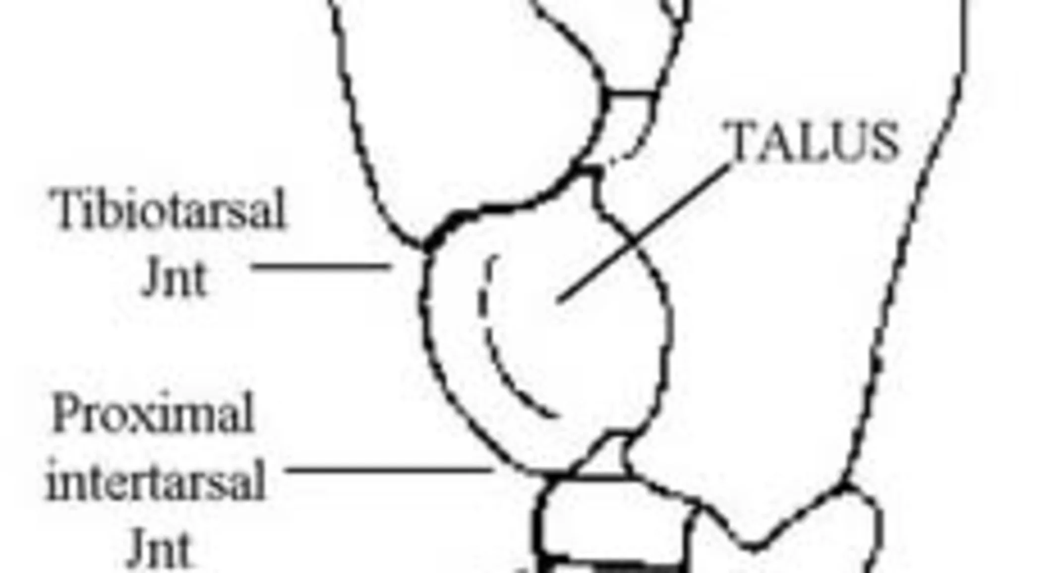 South Shore Equine Clinic & Diagnostic Center Bone Spavin South Shore Equine Clinic & Diagnostic Center Bone Spavin