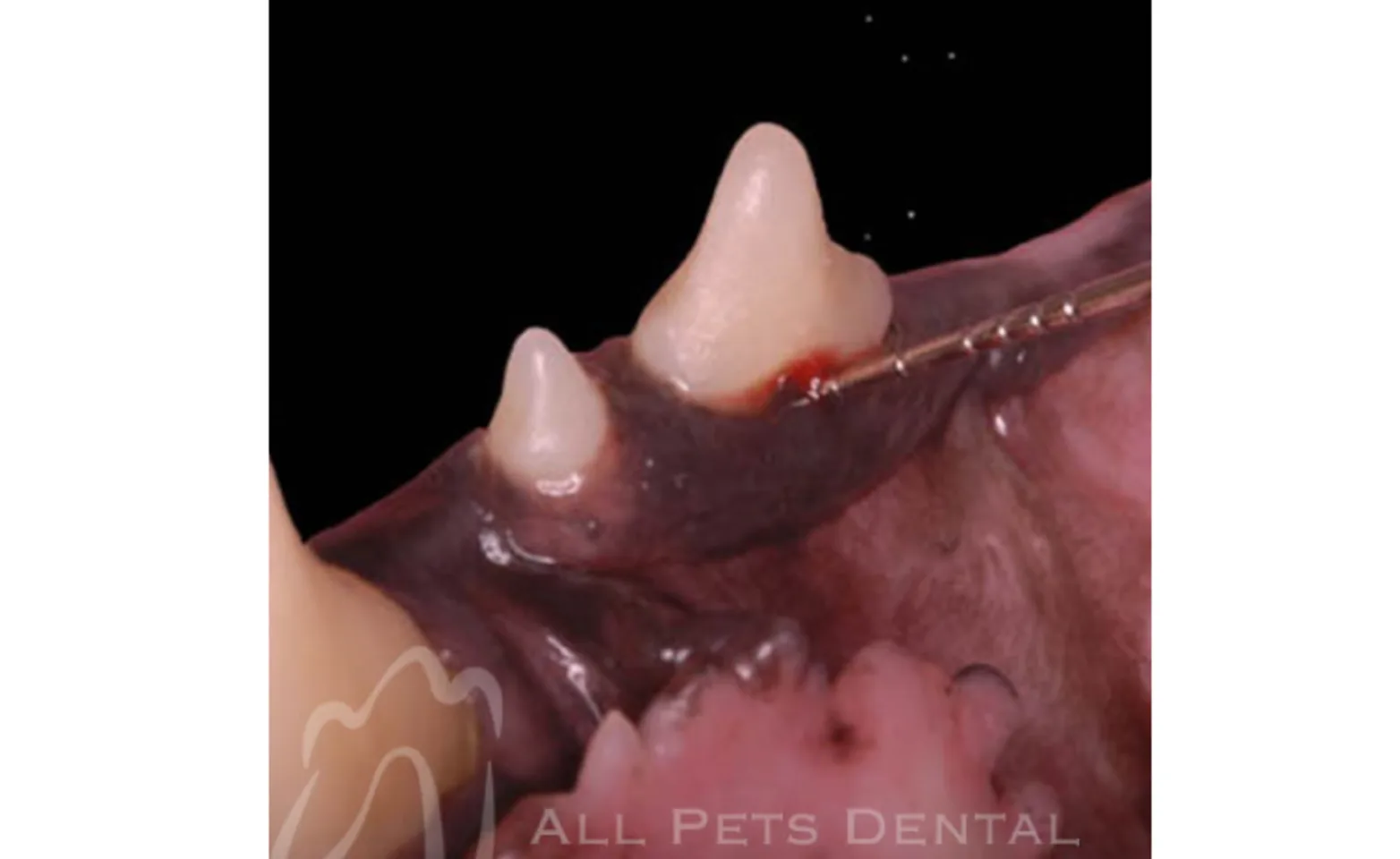 Example of Furcation Involvement Example of Furcation Involvement
