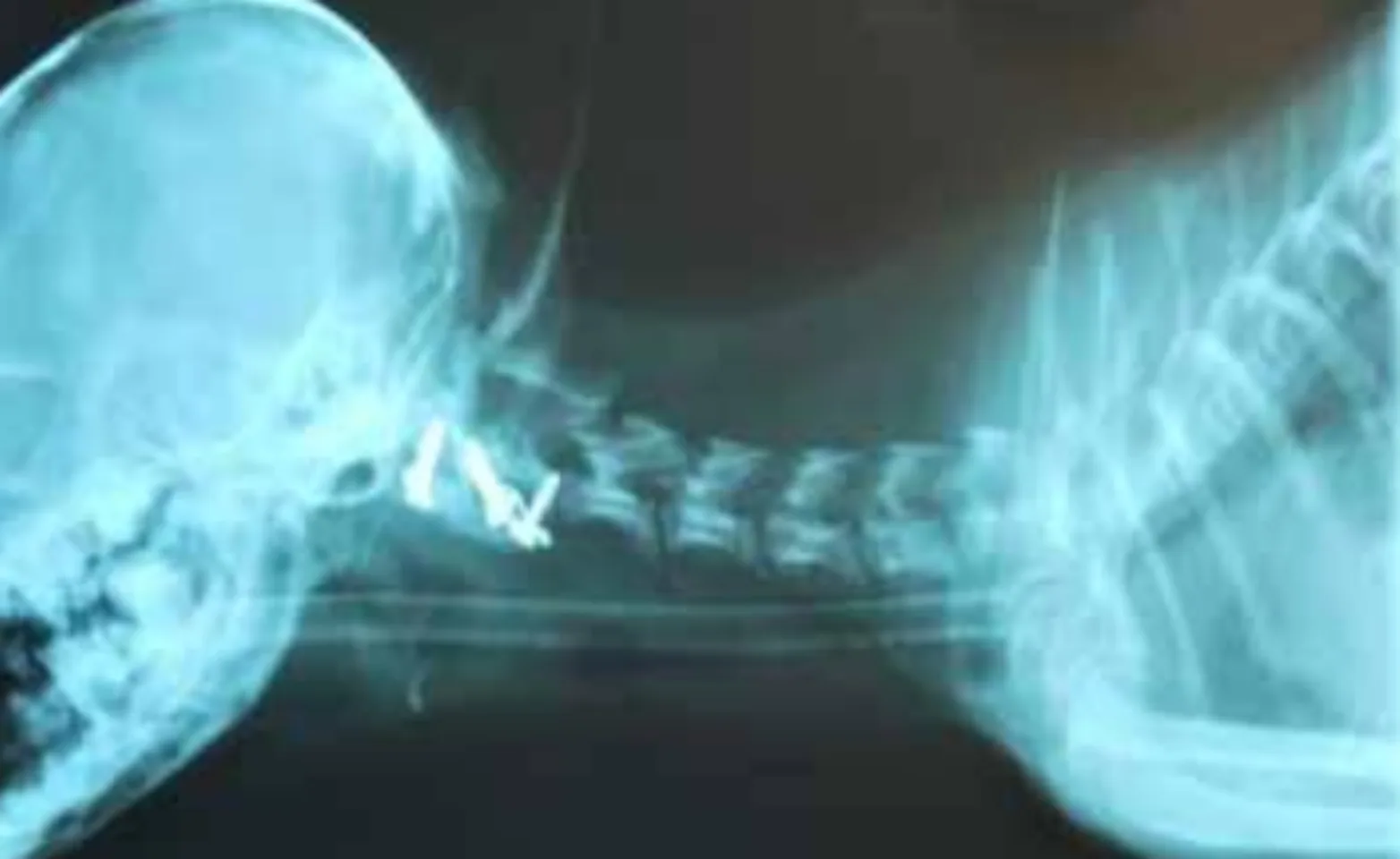 X-Ray image of skull and spinal cord of animal. X-Ray image of skull and spinal cord of animal.