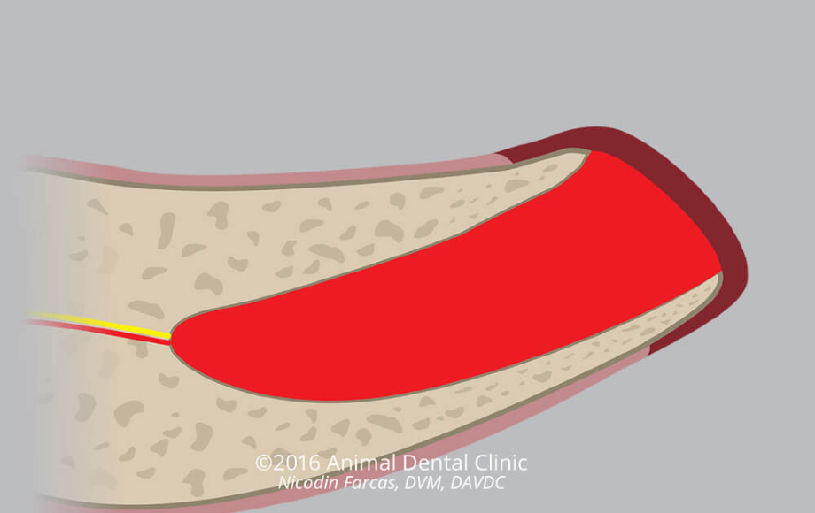 Diagram of tooth extraction