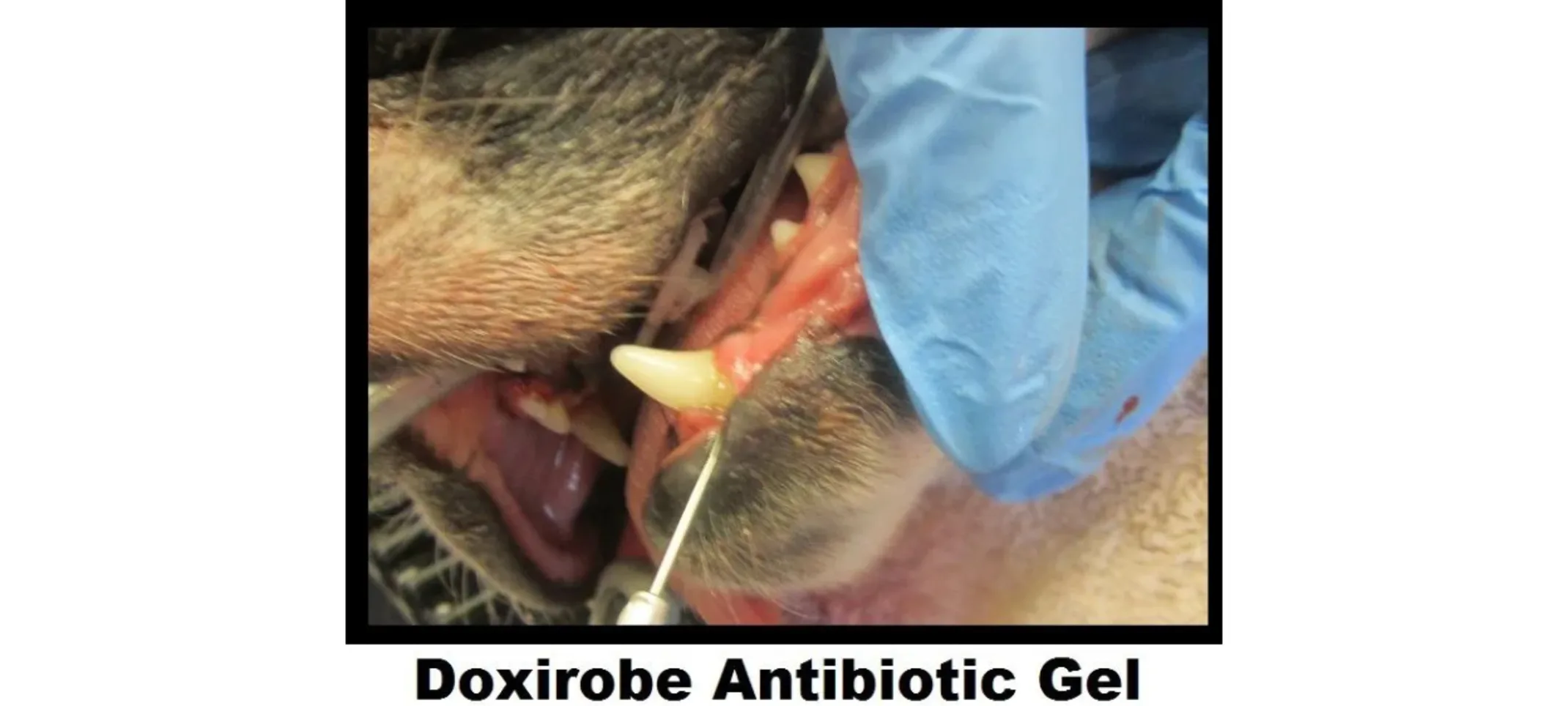 Doxirobe Antibiotic Gel Doxirobe Antibiotic Gel