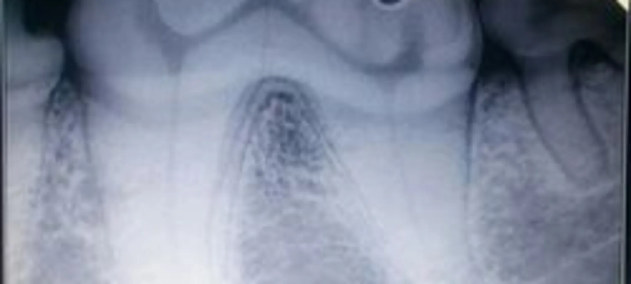 X-ray of dogs teeth X-ray of dogs teeth