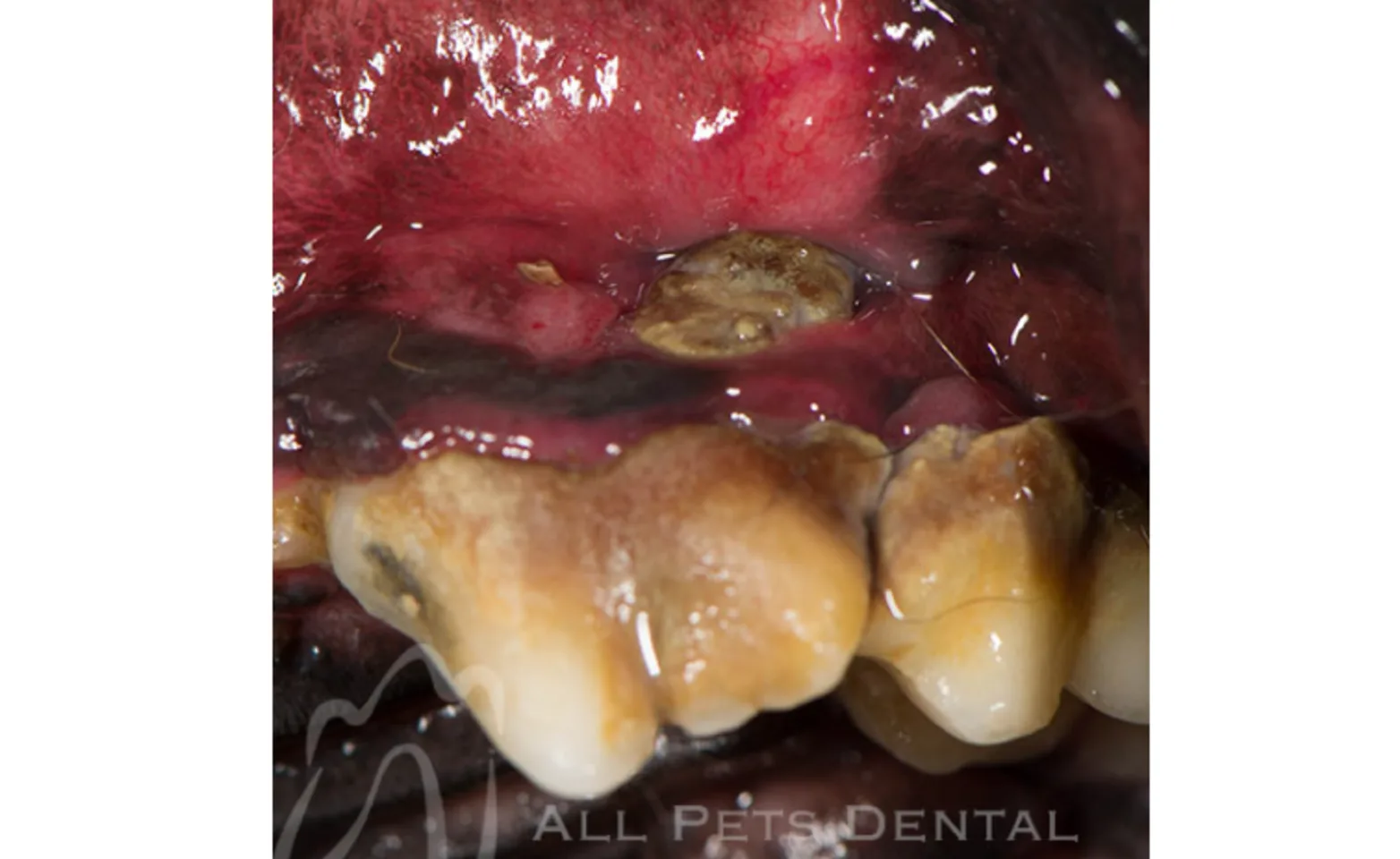 Example of Mucogingival Defects Example of Mucogingival Defects