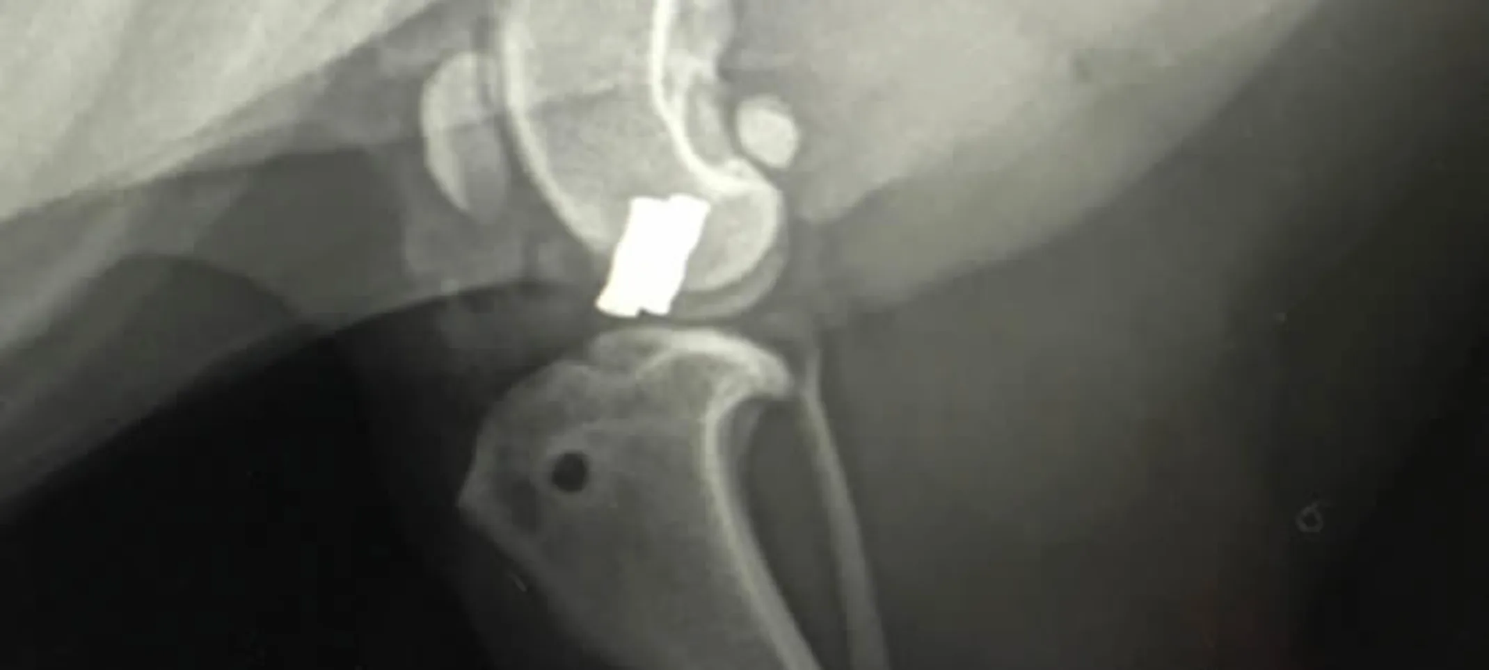 X-ray of cruciate ligament repair X-ray of cruciate ligament repair