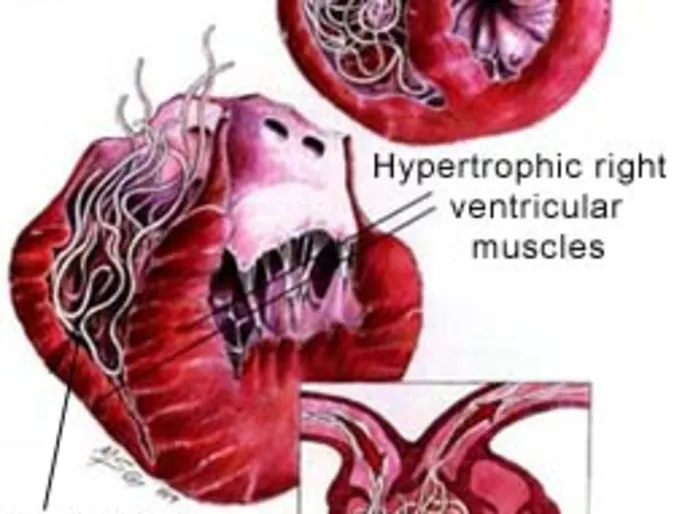 Heartworm Disease Heartworm Disease