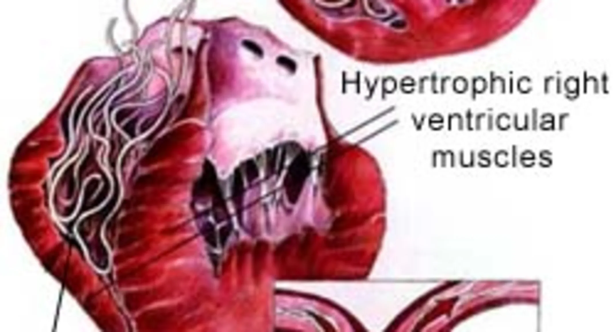 Heartworm Disease Heartworm Disease