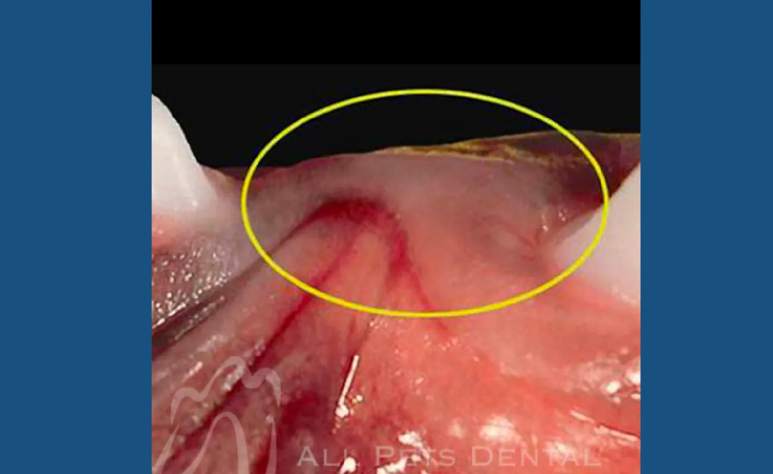 Missing Teeth Missing Teeth