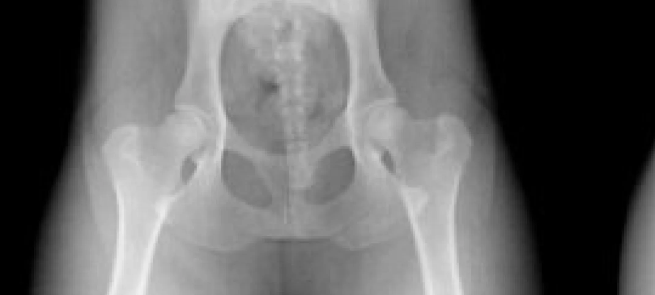 The Orthopedic Foundation for Animals The Orthopedic Foundation for Animals