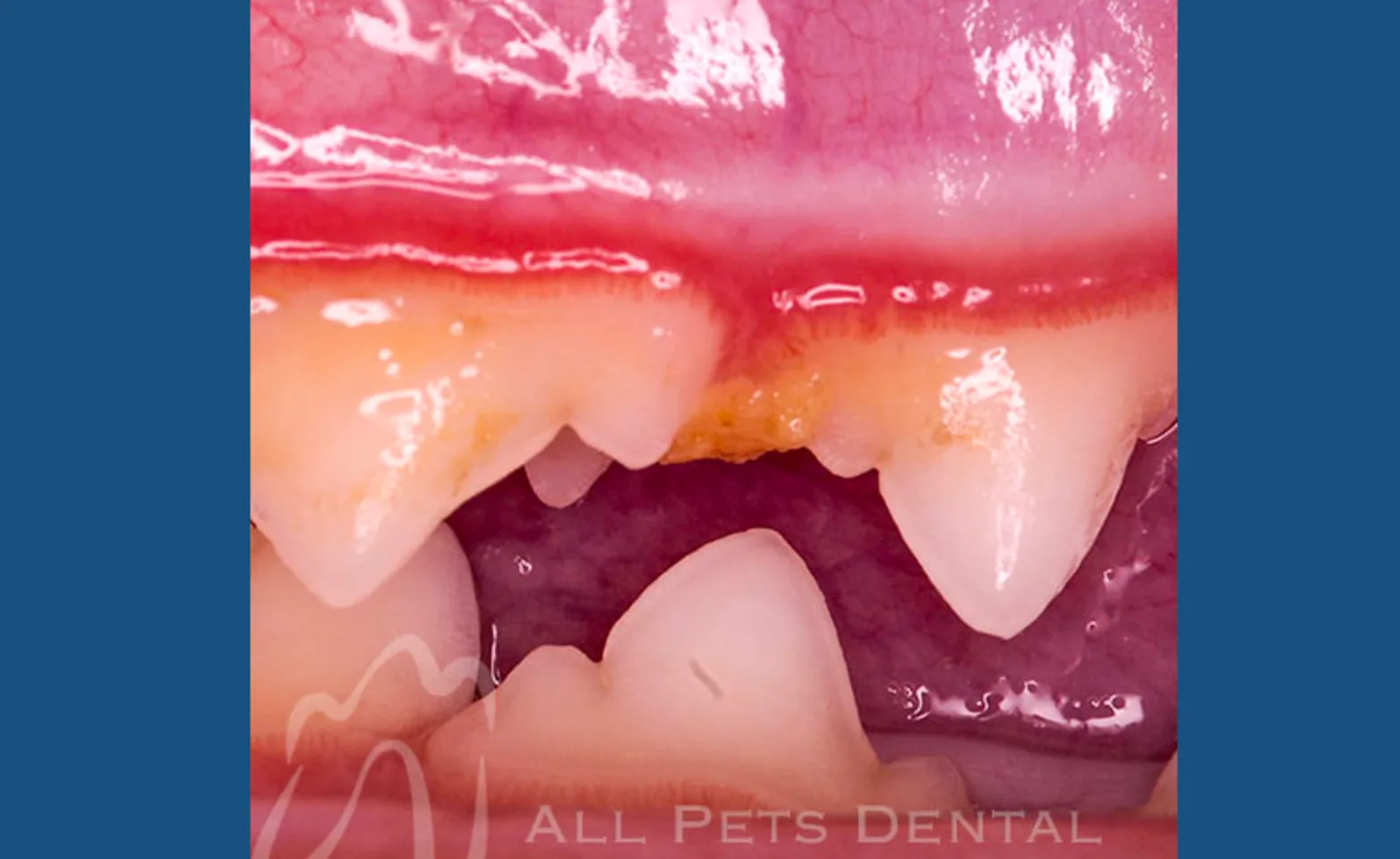Periodontal Stage 1 Periodontal Stage 1