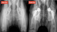 Total Hip Replacement A Complete Information Guide Austin 