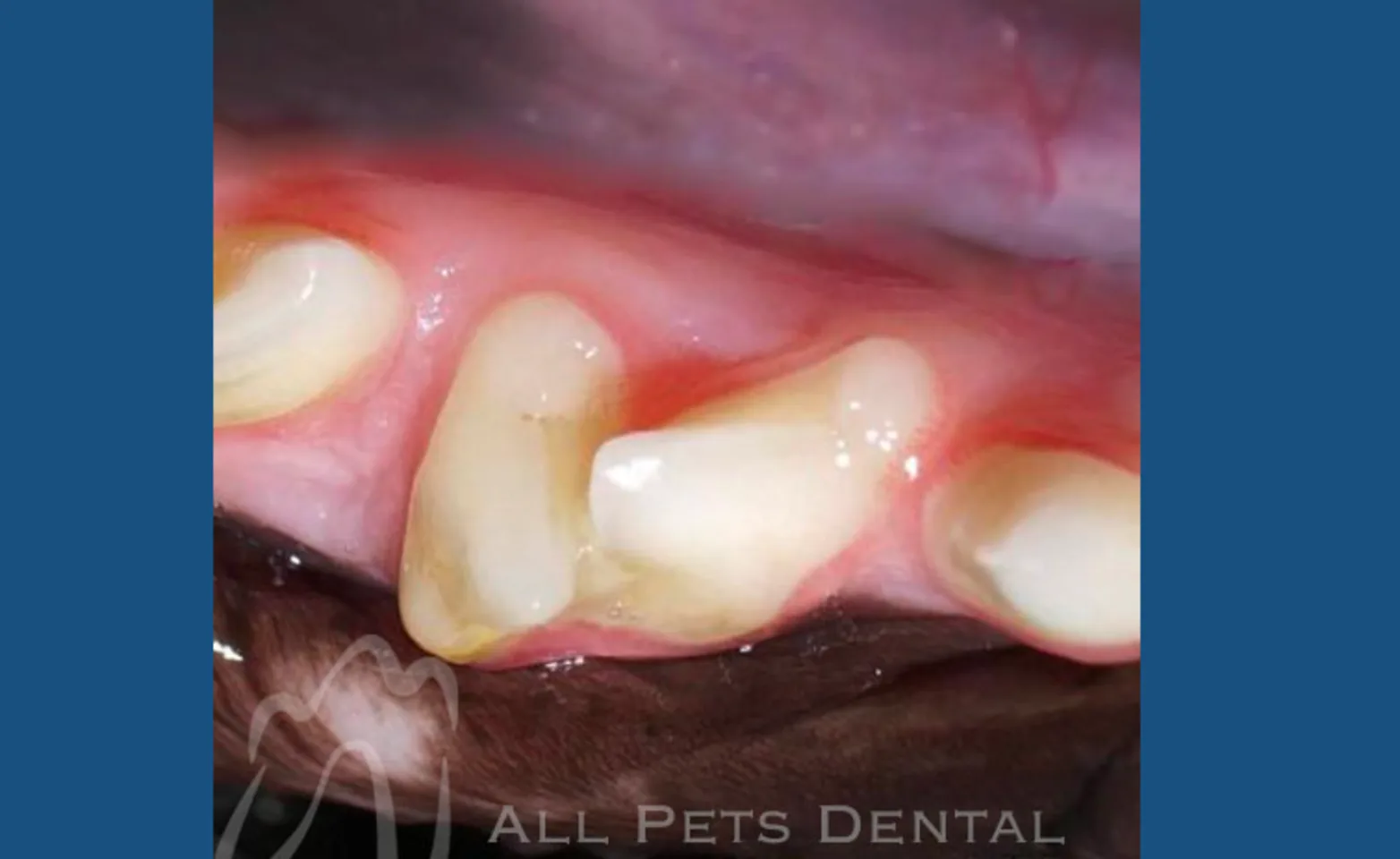 Rotated Teeth Rotated Teeth