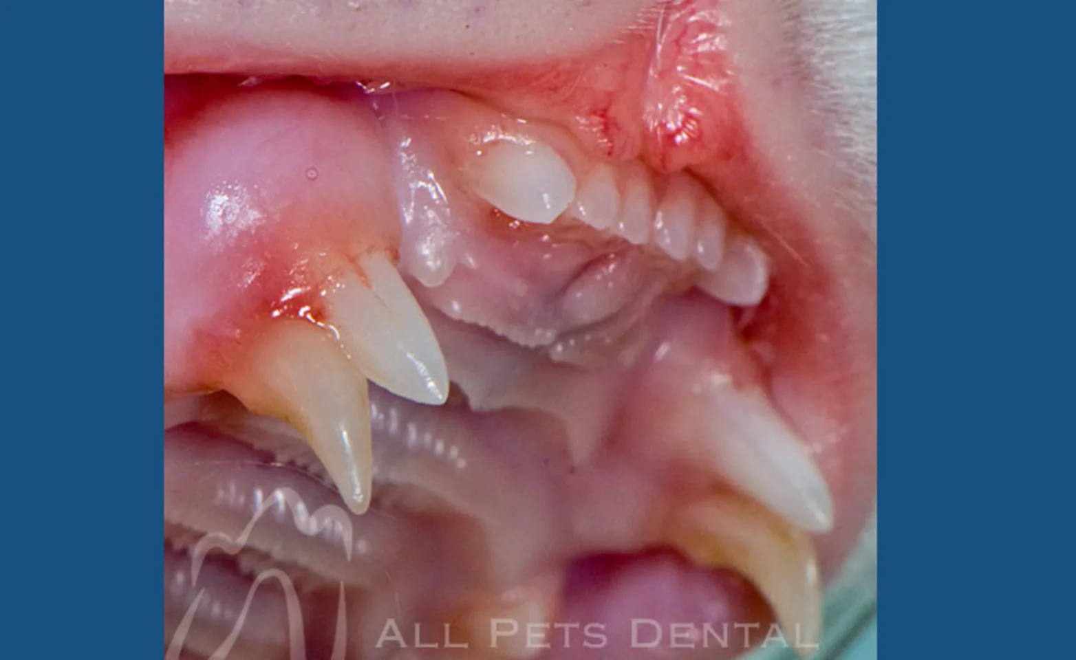 Retained Deciduous Teeth