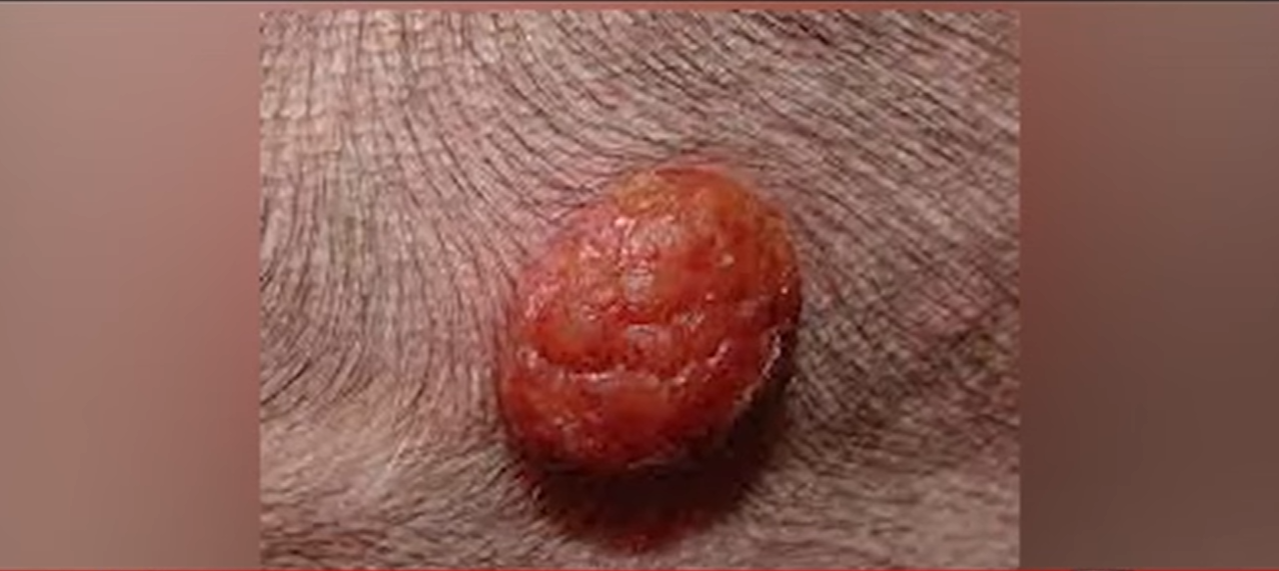 Lump mass on a dog
