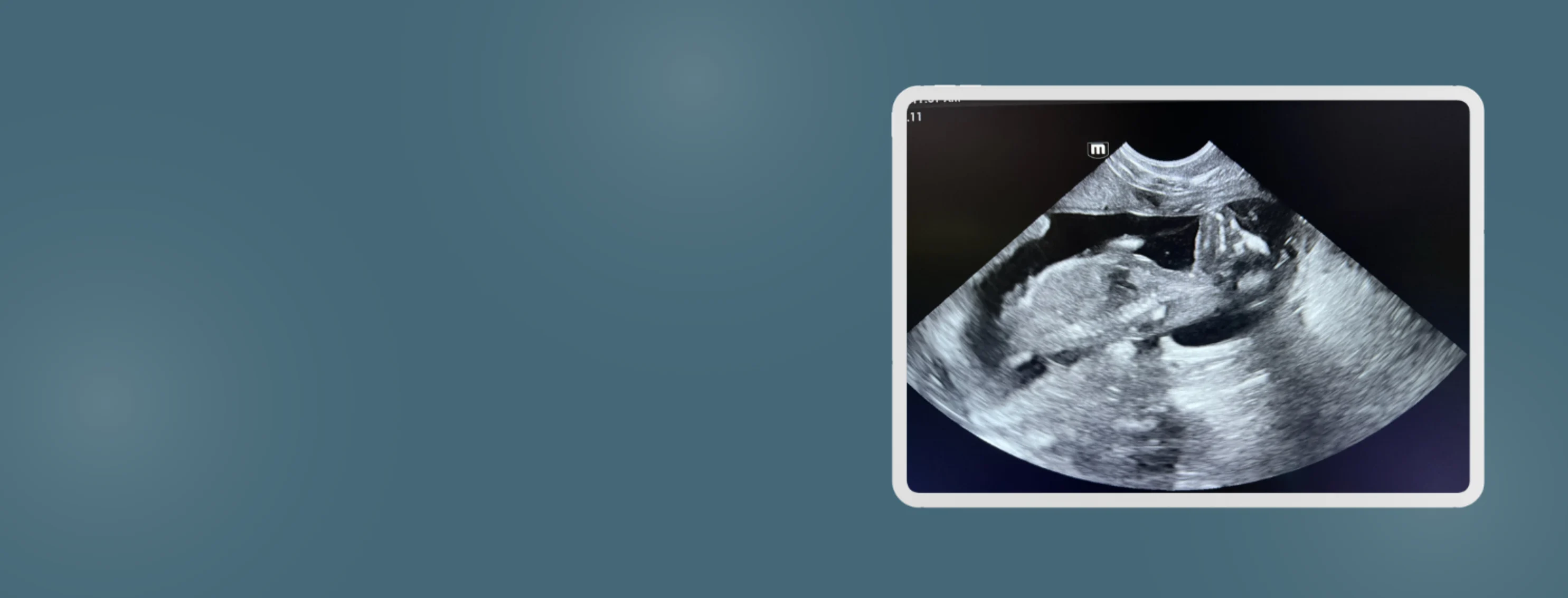 Dog Ultrasound Dog Ultrasound