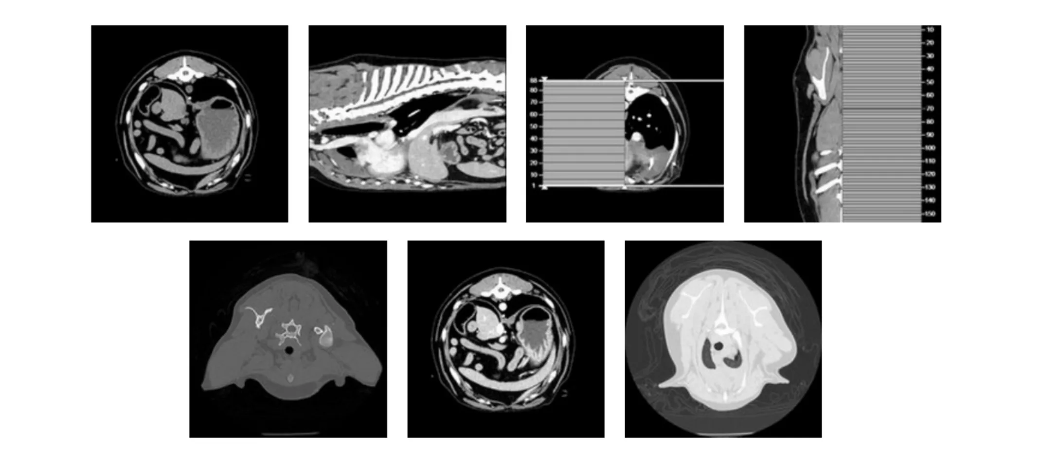 Thoracic CT Scan Thoracic CT Scan