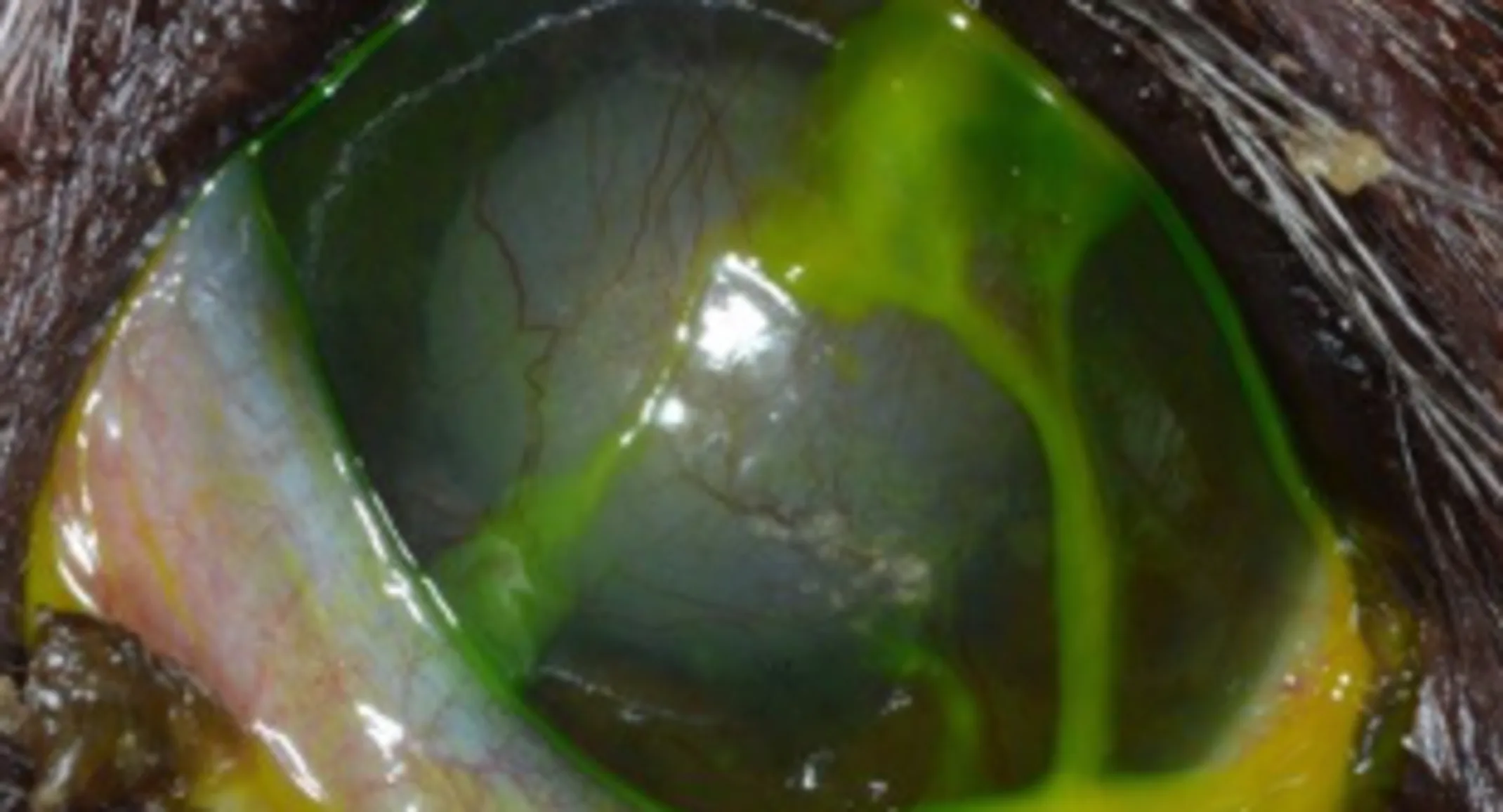 Keratoconjunctivitis sicca (KCS), dry eye disease Keratoconjunctivitis sicca (KCS), also known as dry eye disease
