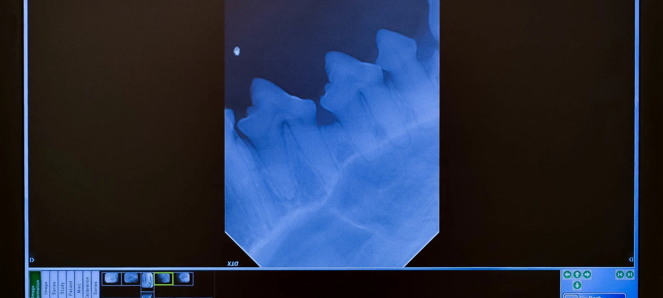 X-ray of dog's teeth