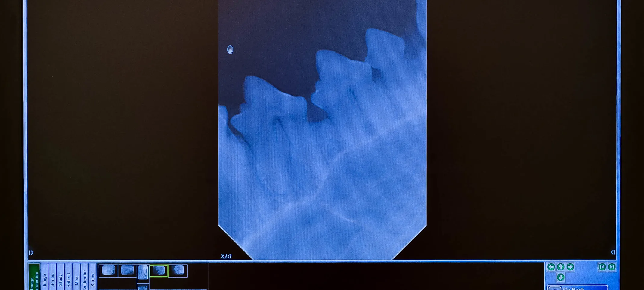 X-ray of dog's teeth