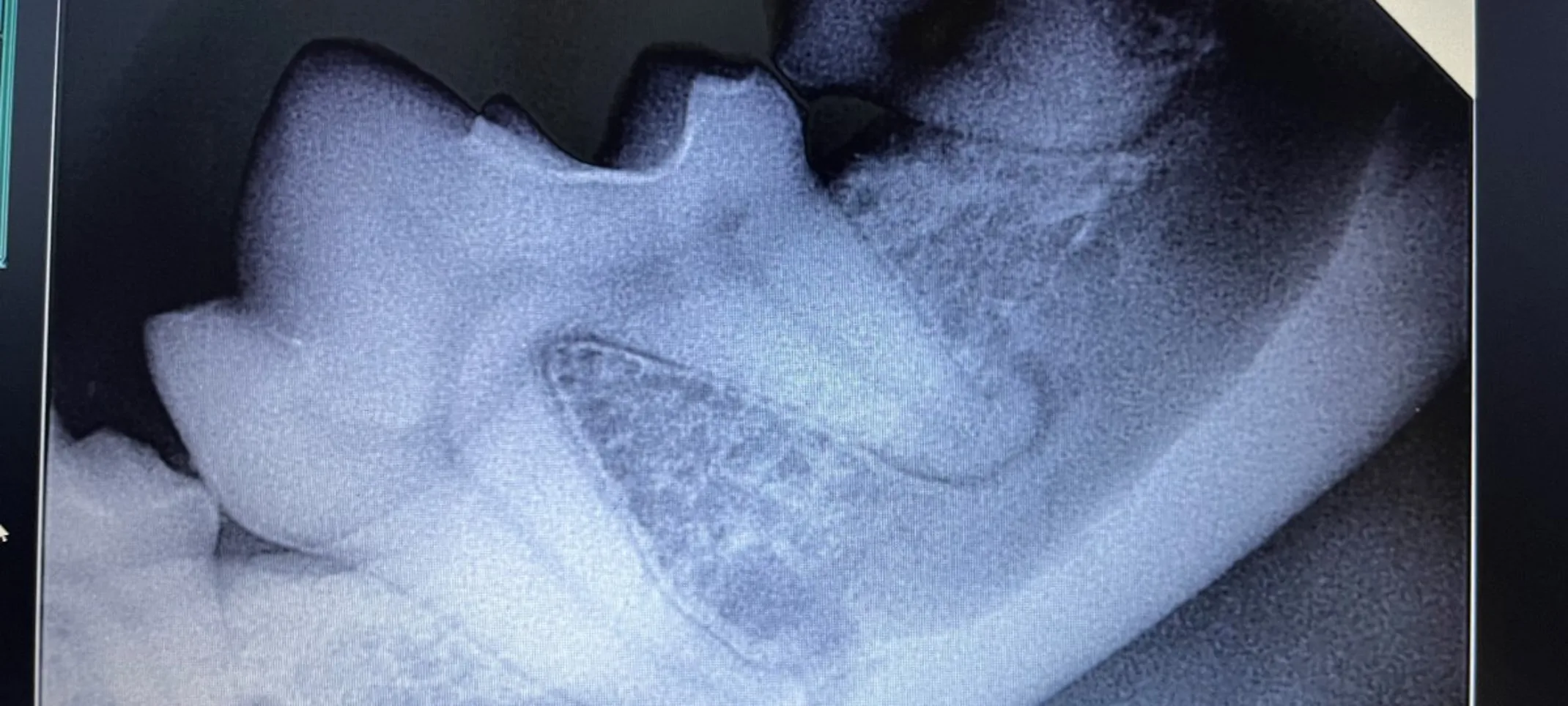 X-ray of dog tooth X-ray of dog tooth