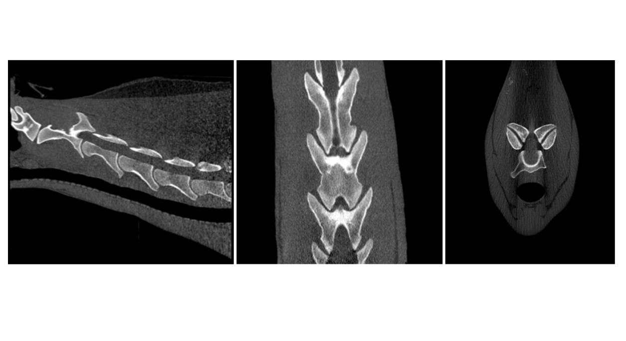 Neck CT Case Study