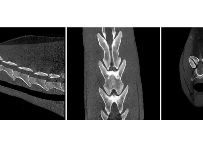 Neck CT Case Study Neck CT Case Study
