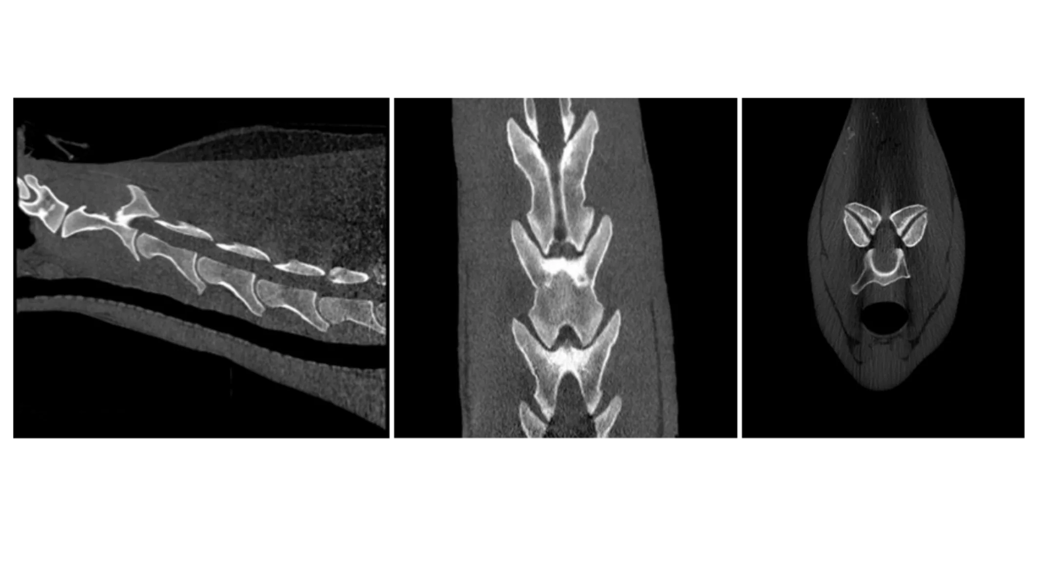 Neck CT Case Study Neck CT Case Study