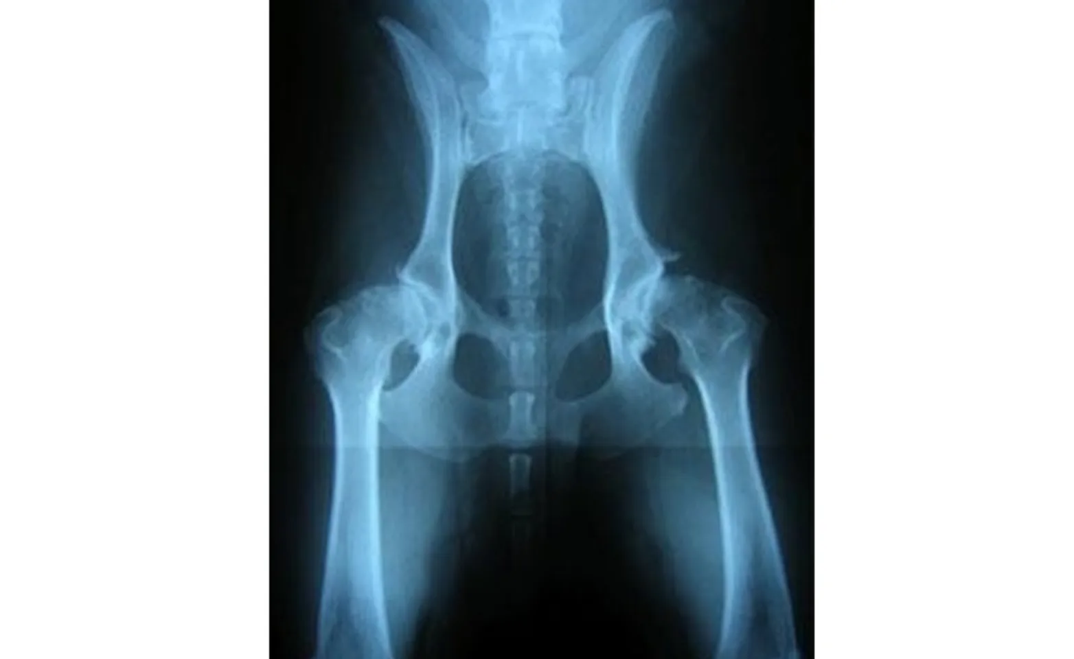 Radiograph of canine hips with severe osteoarthritis seen with the chronic adult form of hip dysplasia.  Radiograph of canine hips with severe osteoarthritis seen with the chronic adult form of hip dysplasia.