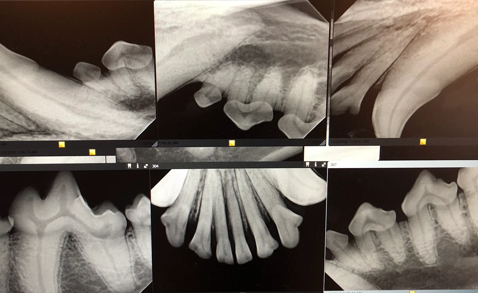 Tooth x-rays Tooth x-rays