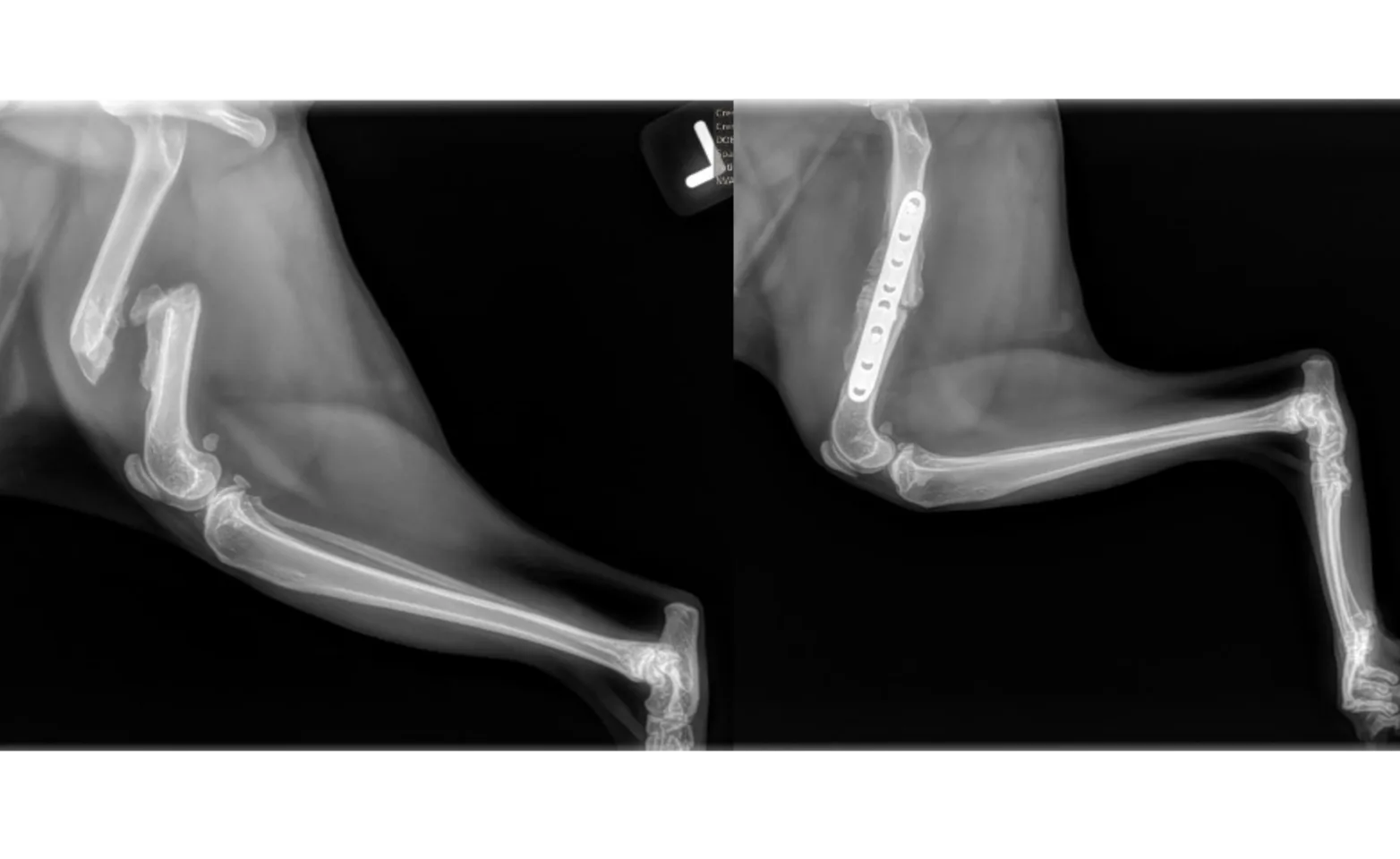Fracture Repairs X-Ray
