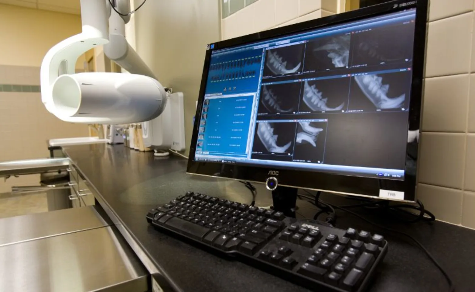 photo of dental xray photo of dental xray