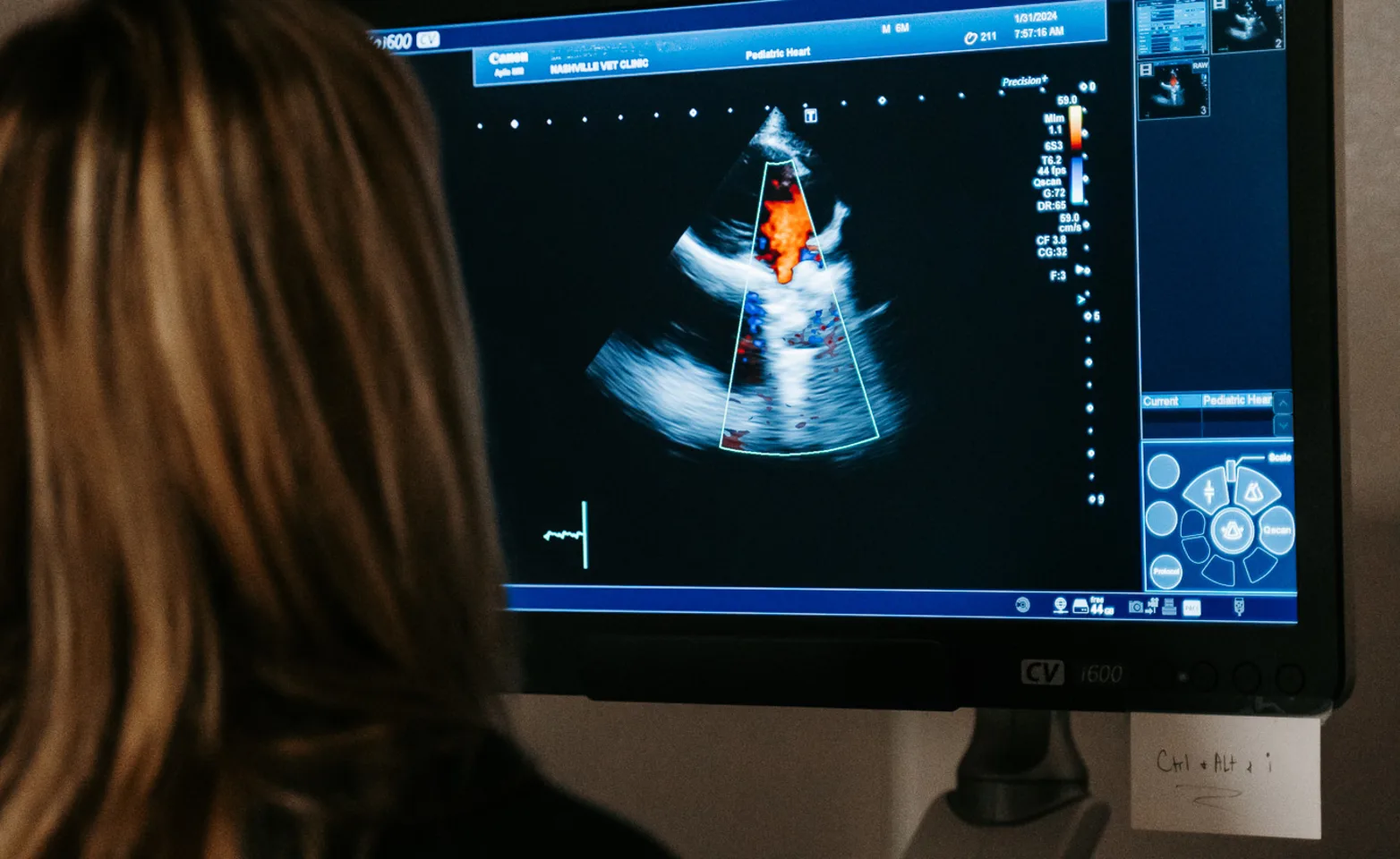 Dr. Kiira Rodriguez performing an echocardiogram on a patient Dr. Kiira Rodriguez performing an echocardiogram on a patient