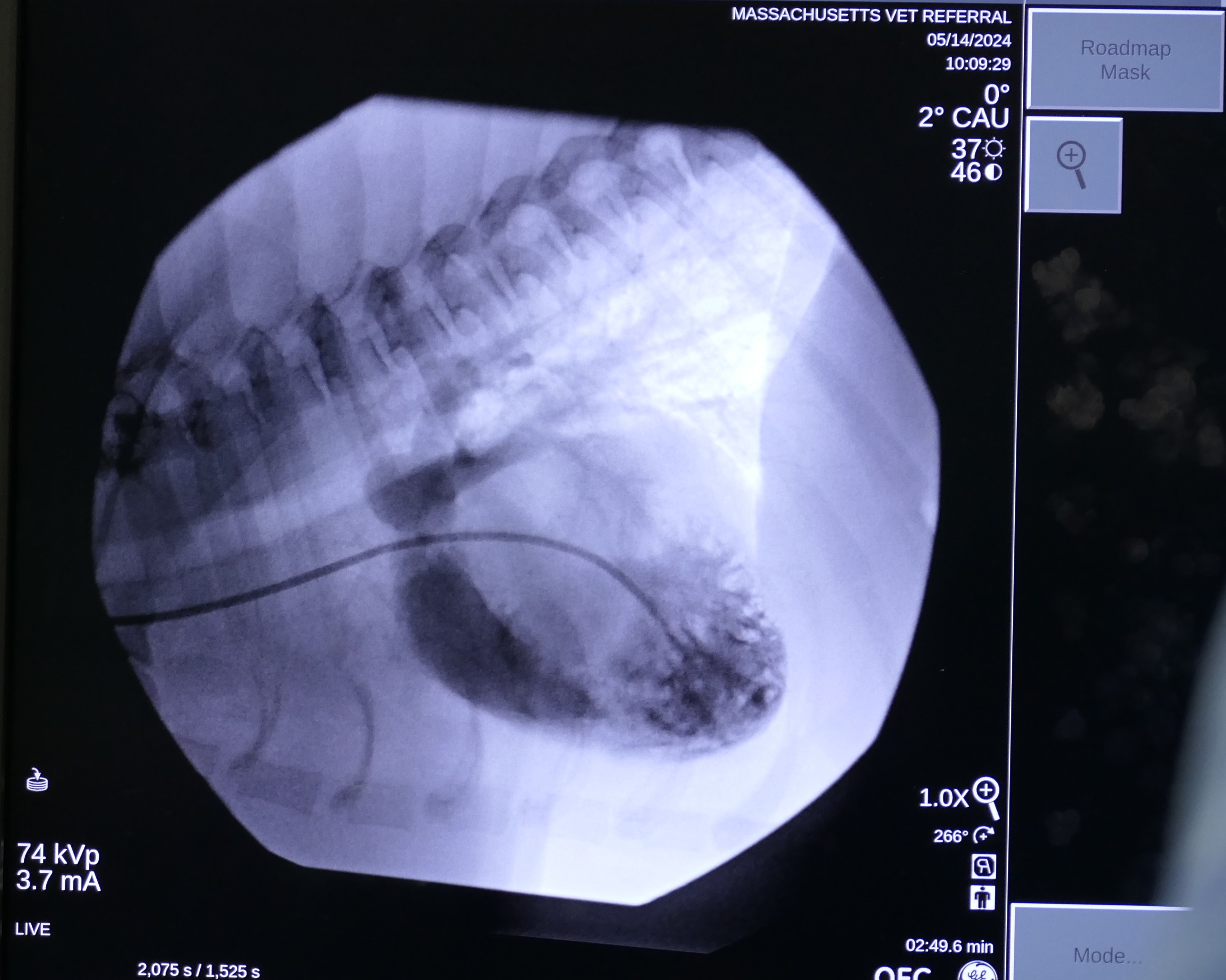 A balloon valvuloplasty in Snoop the dog. 