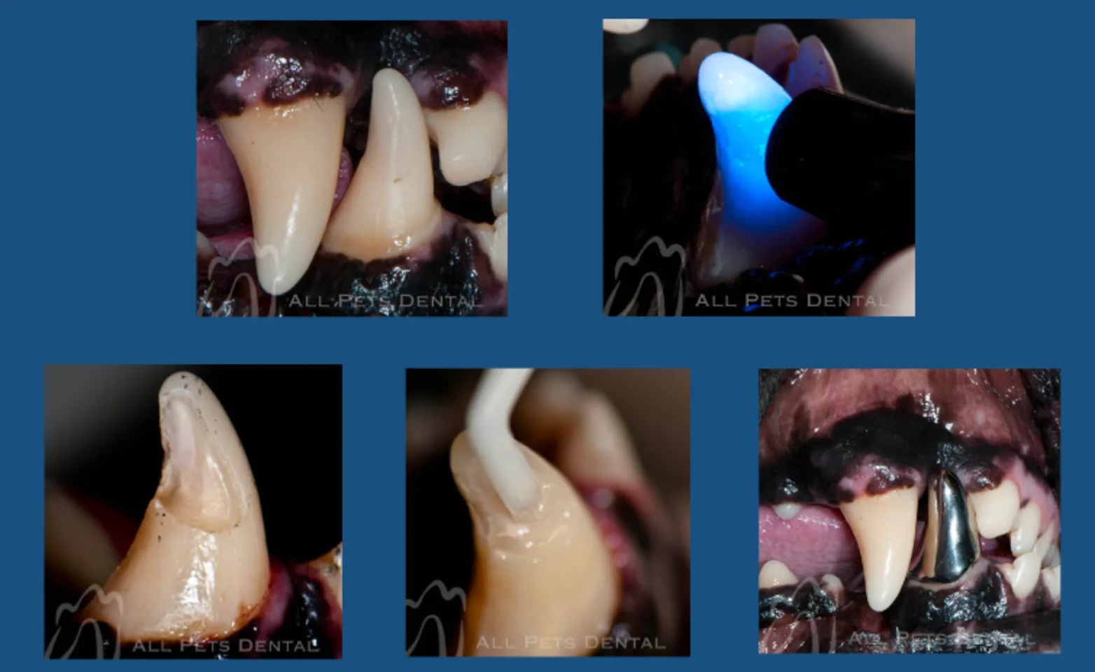 Uncomplicated Crown Fracture 1