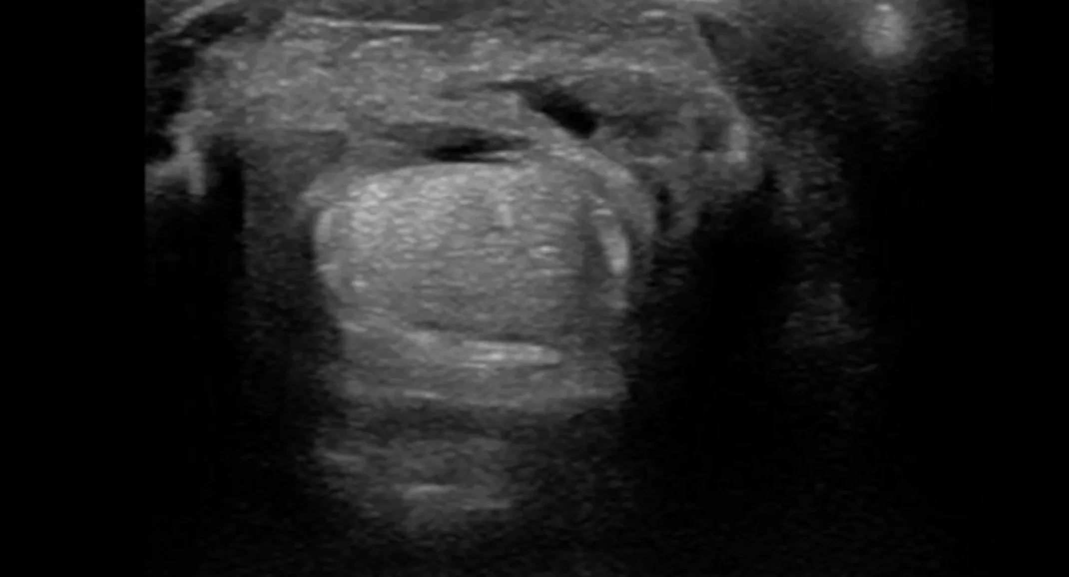 Horse Tendon X-ray Horse Tendon X-ray