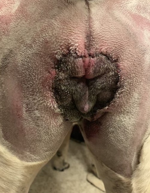 post surgery episioplasty