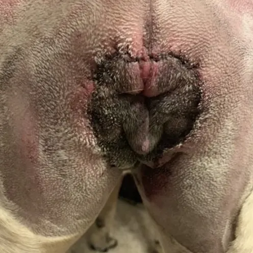 post surgery episioplasty post surgery episioplasty