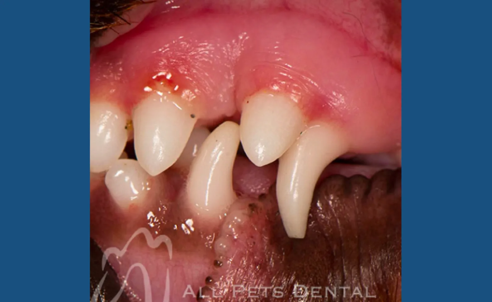 Retained Deciduous Teeth Retained Deciduous Teeth