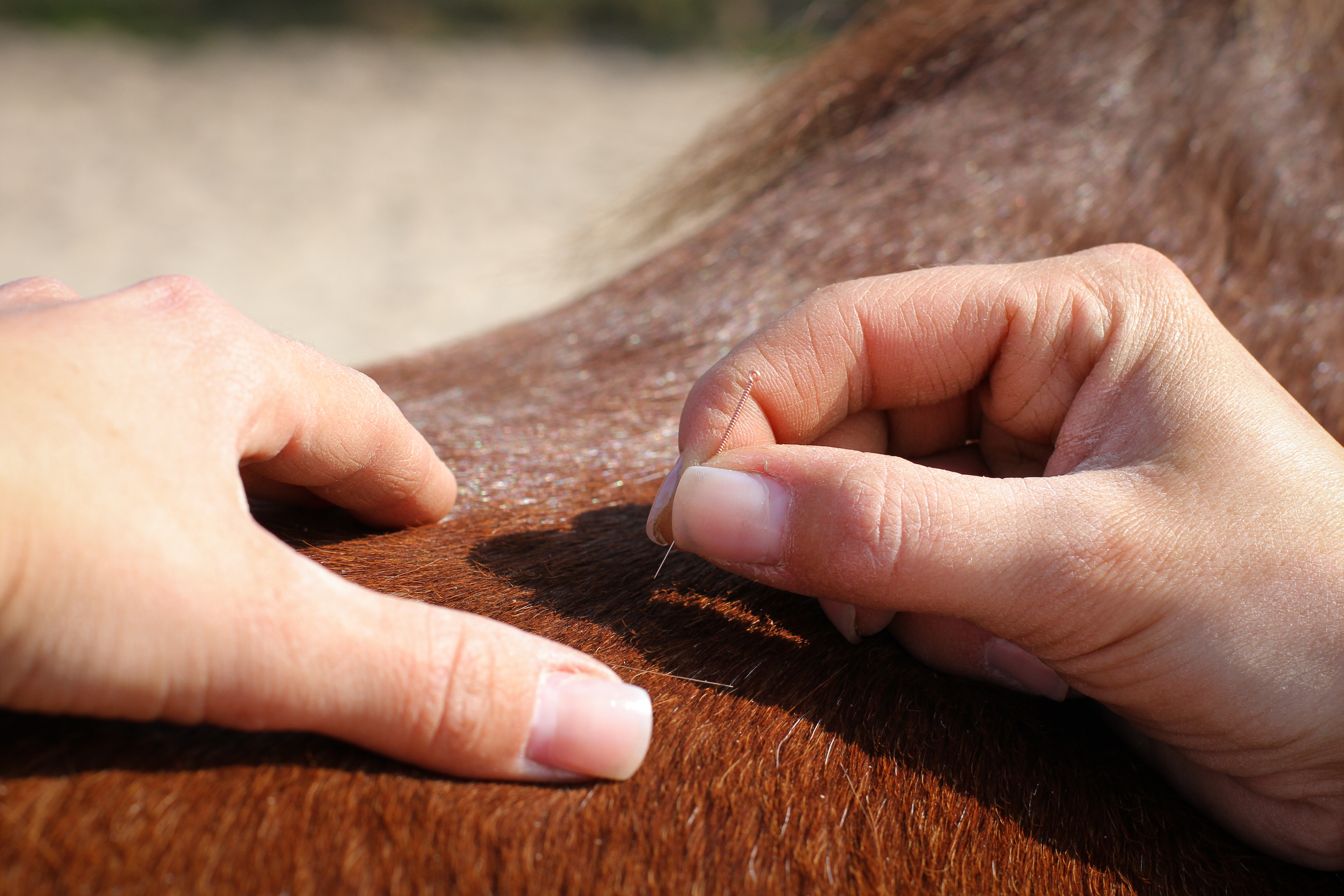 Acupuncture 3
