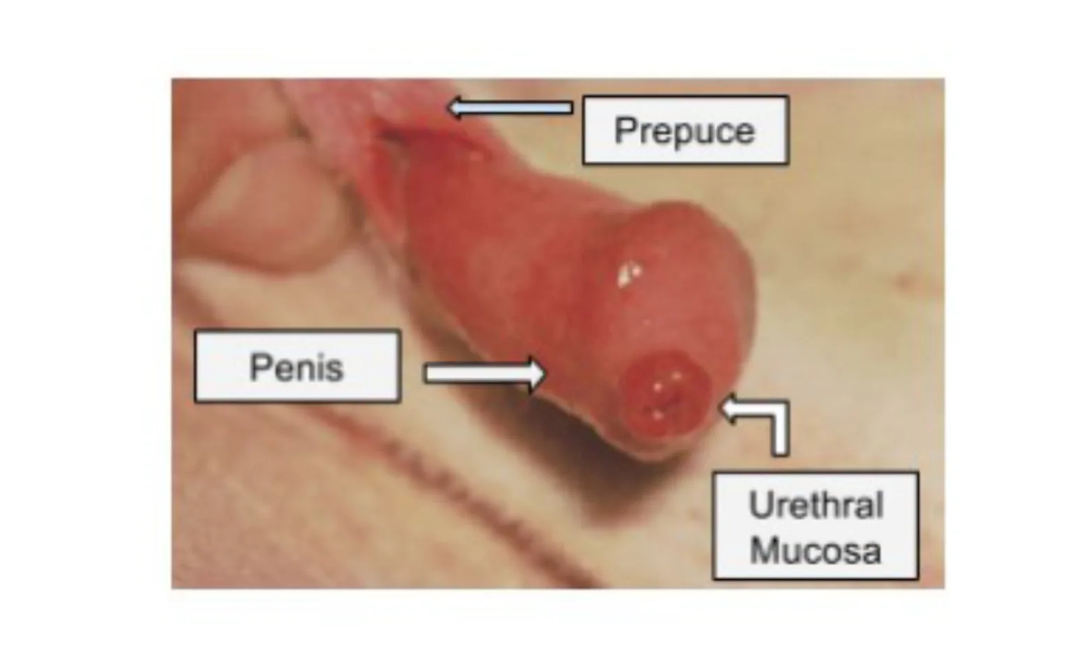 Figure 1. A prolapsed urethra. Photo courtesy of Fossum: Small Animal Surgery 3rdedition<br />Copyright © 2007 by Mosby, Inc., an a Figure 1. A prolapsed urethra. Photo courtesy of Fossum: Small Animal Surgery 3rdedition<br />Copyright © 2007 by Mosby, Inc., an a