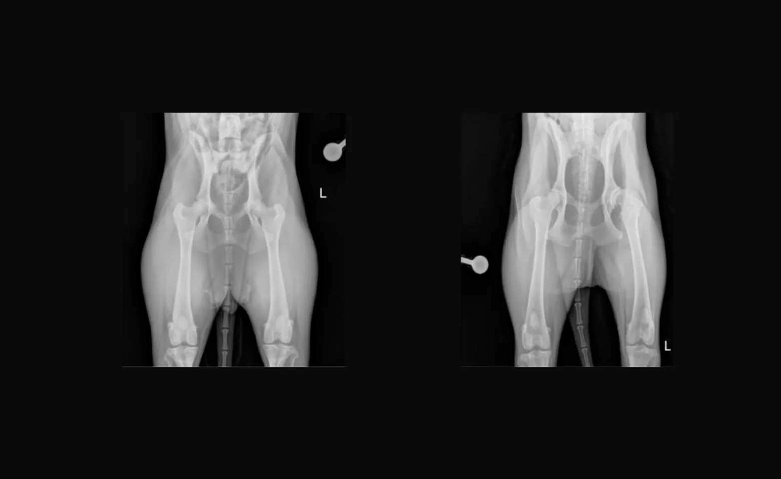 Xrays for Total Hip Replacement Xrays for Total Hip Replacement