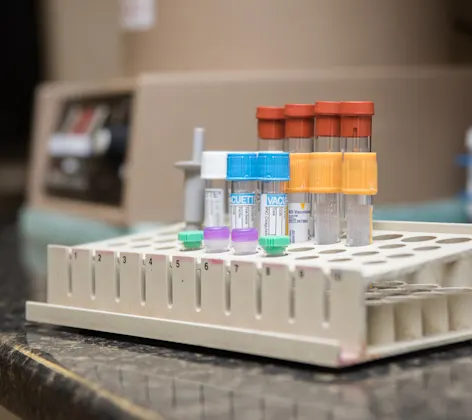vaccine tubs vaccine tubs