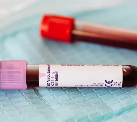 Sample collection tubes Sample collection tubes